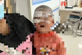 心疼！北海2岁男孩被狂犬咬伤，缝了20针，三天后复诊愈合良好图片