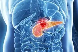 小腿肿胀，别不当回事！腿上的这4种变化，及时警惕癌症图片