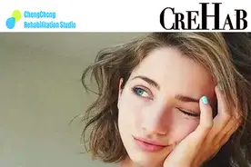 “大小脸” 究竟是怎样形成的？图片