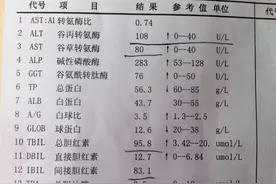 体检查出转氨酶升高怎么办？教你3种方法降低转氨酶图片