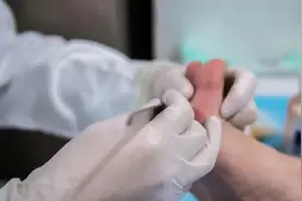 10岁男孩上游泳课脚底长满小疙瘩，医生：感染了HPV图片