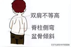 青少年脊柱侧弯怎么办，推拿整脊正当时！图片