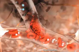 只用1年时间，血管狭窄从60%到50%，他的做法，成功救了自己一命图片