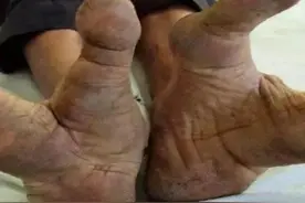 难道鸟族人真的存在，一群长着两个脚趾头的人，跟鸵鸟一样图片