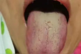 敢说真话！每天一杯连花清瘟，真的能预防新冠吗？图片