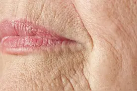 皮肤科的明星药，除皱抗衰它也行图片