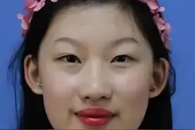 6年前，95后女孩花百万把自己整成“刘亦菲”，连名字都要模仿图片