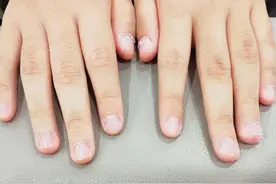 俗语“十指偏斜劳碌命,骨节暴露愁心人”，这种手指多为辛苦命！图片