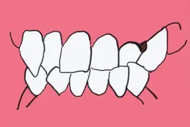 注意！70%的孩子需要在这个阶段去矫正牙齿，否则会影响颜值图片