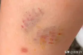 沪一女童被狗咬伤，狗主人蛮不讲理惹众怒！最新进展→图片