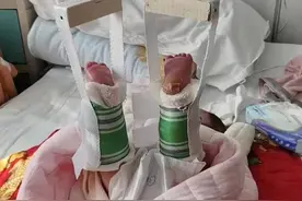 剖腹产新生儿异常哭闹两天查出大腿骨折，女子举报病历不实，医院遭处罚，律师：医院病历不实或被推定全责图片