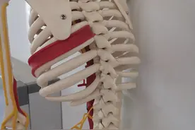 右肘酸痛的远控治疗图片