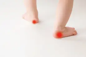 小朋友喊足跟痛，家长们应该怎么办？图片