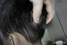 这3个地方是孩子的“生命线”，父母再生气也不能打，别造成遗憾图片