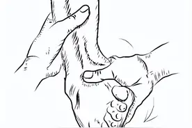 腰骶部相关的神经根定位图片