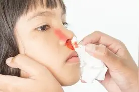 警惕！孩子流鼻血，有这6种情况一定要及时去医院图片