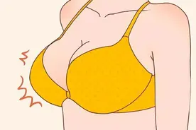 胸部都有哪些常见的不美观形态？图片