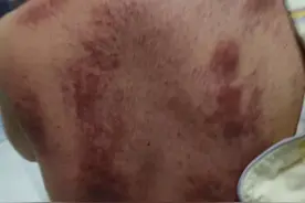 月子里堵奶的一系列傻操作，宝妈们不要再踩坑图片