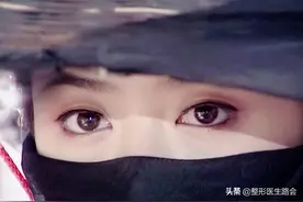 为什么三甲医生不建议做“眼睑下至”？答案揭晓，不妨了解一下图片