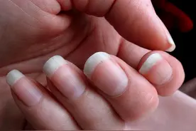 为什么有的人指甲上有月牙，有的没有？看完涨知识了图片