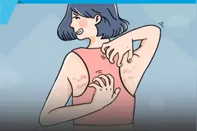 挠痒痒会传染？为什么皮肤会越抓越痒？图片