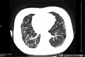 一级致癌物“石棉”，潜伏期可达15年，你用过的这些物品都有图片