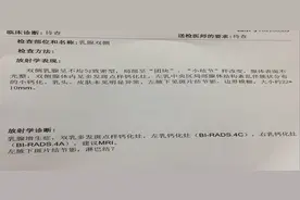 乳腺癌钼靶报告单该怎么看？教你读懂乳腺钼靶报告图片