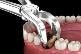 突然掉了一颗牙，牙齿缺失了，三种修复手段哪种会比较好？图片