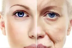 女性雌激素不足，通常会有这5个表现！用这4个方法能补回来图片