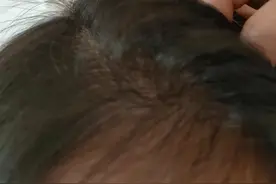 食疗拯救了我的头发图片