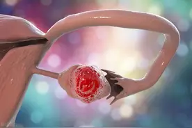 卵巢癌是“沉默的杀手”，病发时除了腹痛，还有哪些异常图片