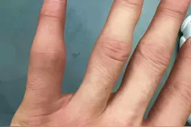 “爸，你都不知道有多疼！”郭艾伦老爸帮儿子按摩疗伤图片