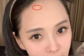 伊能静首曝额头疤痕由来，否认是整容后遗症，大方承认割过双眼皮图片