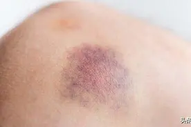 鬼捏青、鬼压床，这些见鬼现象是何原因？并不是真的见了鬼图片