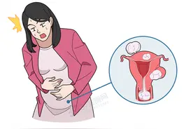 妇科医生：有没有子宫肌瘤，肚子症状来判断，这4种情况别无视图片