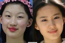 19岁少女非要整成“刘亦菲”，连名字也高仿，6年后她现状怎样？图片