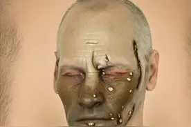 10年前的一次寻花问柳，让我染上梅毒，让我的人生坠入至暗时刻图片