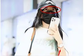 47岁的赵薇近照手臂淤青，罪行不止亲日辱华，如今被爆家暴要离婚图片