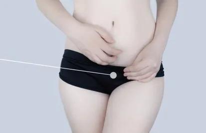 妇科盆腔炎，附件炎症，带下绵绵不断有异味，总结几款常用药！