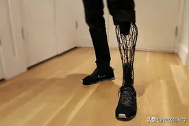 活蛆也能治病？英国男子因感染面临截肢，400条活蛆救了他一命图片