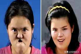 陕西农民捡到畸形女婴，哥哥赚钱为妹妹整容，她变美后嫁给了哥哥图片