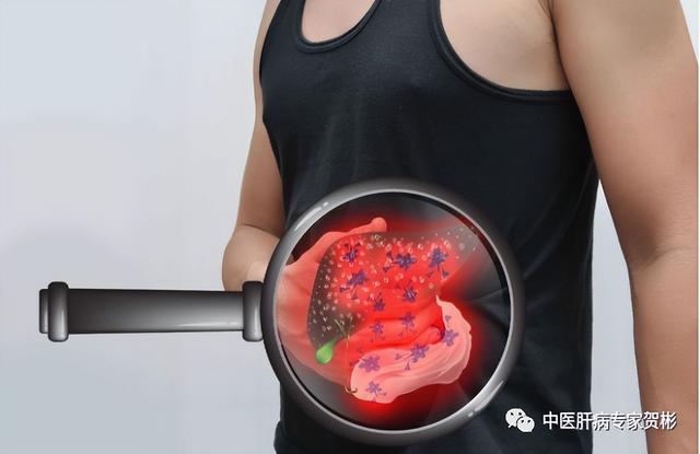 肝硬化腹水能治愈吗？记住这几点，治愈不是梦