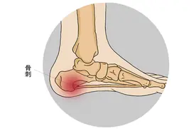 经常足跟痛，是肾虚了吗？3种行为在“损耗”你的肾气，尽快改正图片