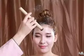 艾灸治过敏性鼻炎图片