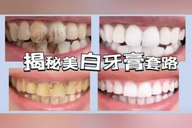 “美白牙膏”真有那么神？记者做了个试验……图片