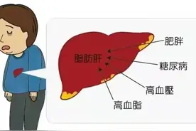 门诊体检发现脂肪肝，病情知多少？图片