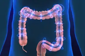 结合最新文献整理——溃疡性结肠炎的诊断与治疗图片