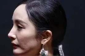 满脸痘、皱纹多，明星离开了美颜，生图还不如普通人图片