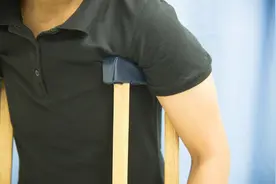 骨折后钢板一定要取？取出的钢板，为什么不能带回家吗？真相来了图片