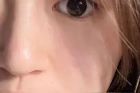 长斑脸都用这个祛斑霜，淡斑之后都变年轻了图片